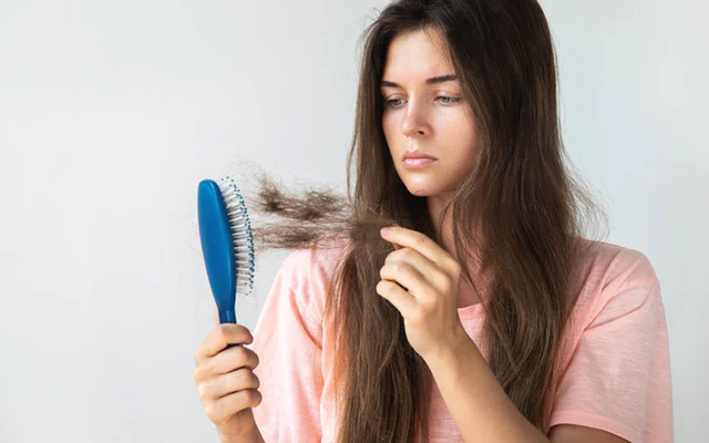 Does PCOS Lead To Hair Loss?